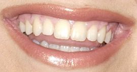 Picture of Kelly Clarkson's teeth and smile
