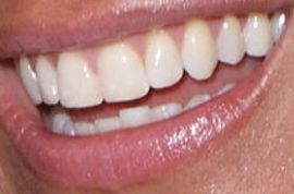 Picture of Kelly Killoren Bensimon teeth and smile