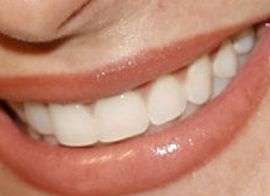 Picture of Kelly Monaco teeth and smile