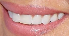 Picture of Kelly Monaco teeth and smile