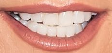 Kelly Ripa's teeth and smile