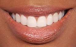 Kelly Rowland's teeth