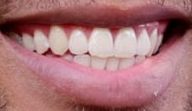 Picture of Kendrick Sampson teeth and smile