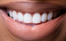 Picture of Khadijah Haqq teeth and smile