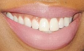 Picture of Khadijah Haqq teeth and smile