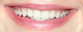 Picture of Kiernan Shipka's teeth while smiling