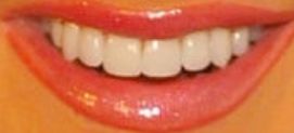 Picture of Kim Zolciak-Biermann teeth and smile