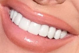 Picture of Kim Zolciak-Biermann teeth and smile