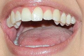 Picture of Kirsten Storms teeth and smile