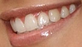 Picture of Kirsten Storms teeth and smile