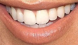 Picture of Kourtney Kardashian teeth and smile