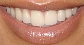 Picture of Kourtney Kardashian teeth and smile