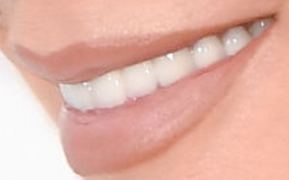 Kris Jenner's teeth