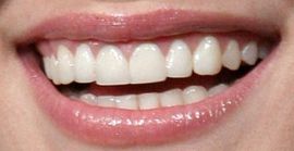 Picture of Kristen Bell teeth and smile