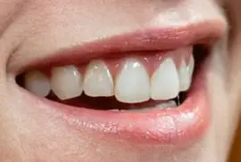 Picture of Kristen Stewart teeth and smile