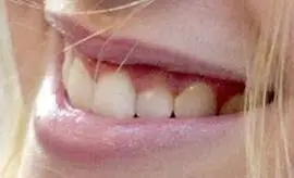 Picture of Kristen Stewart teeth and smile