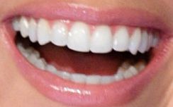 Kristin Cavallari's teeth