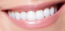 Kristin Cavallari's teeth