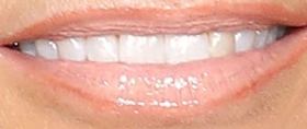 Picture of Kristin Chenoweth teeth and smile