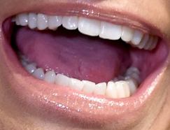 Picture of Kristin Chenoweth teeth and smile