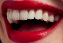 Picture of Krysten Ritter teeth and smile