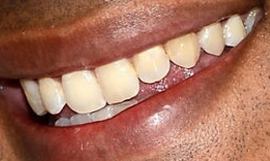 Picture of Kunal Nayyar teeth and smile