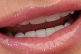 Picture of Kyle Richards teeth and smile
