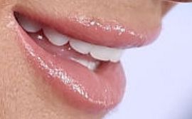 Picture of Kyle Richards teeth and smile