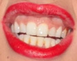 Lady Gaga's teeth