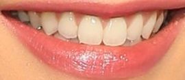 Picture of Lana Condor teeth and smile