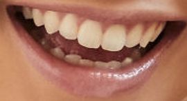 Picture of Lana Condor teeth and smile