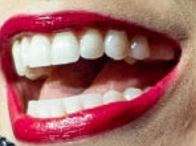 Picture of Laura Osnes teeth and smile