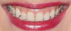 Picture of Laura Slade Wiggins teeth and smile