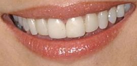 Picture of Lauren Graham teeth and smile