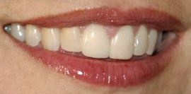 Picture of Lauren Graham teeth and smile