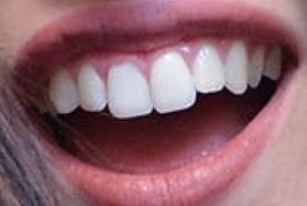 Picture of Lauren Jauregui teeth and smile