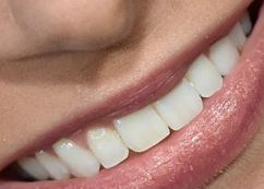 Picture of Lauren Lapkus teeth and smile
