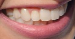 Picture of Lauren Lapkus teeth and smile