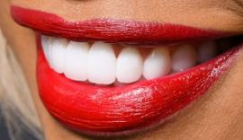 Picture of Laverne Cox teeth and smile