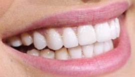 Picture of Lea Michele teeth and smile