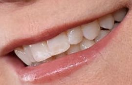 Picture of Lea Thompson teeth and smile