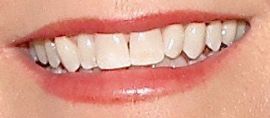 Picture of Lea Thompson teeth and smile