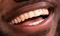 LeBron James teeth