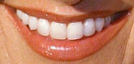Picture of Lee Ann Womack teeth and smile