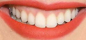 Picture of Leighton Meester teeth and smile
