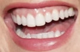 Picture of Leighton Meester teeth and smile