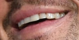 Picture of Leonardo DiCaprio's teeth while smiling