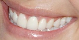 Picture of Leslie Bibb teeth and smile