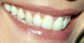 Picture of Leslie Bibb teeth and smile