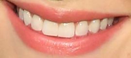 Picture of Lili Reinhart teeth and smile